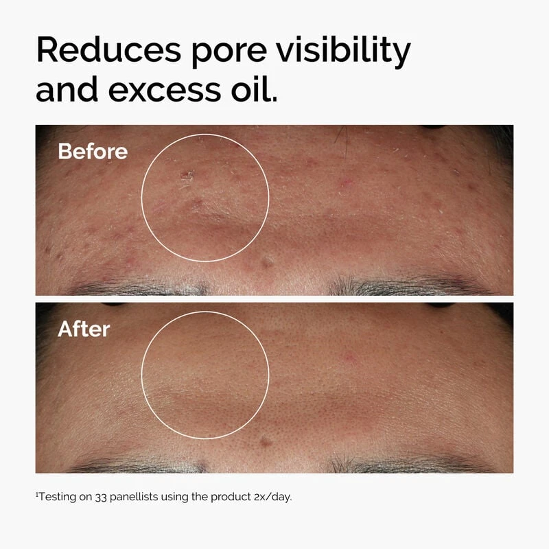 crm/additional_product_images/the ordinary face serum 4.webp